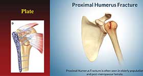 Fractures and Dislocations
